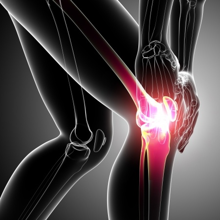 Knee Pain Solutions