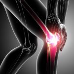 Common Causes of Knee Pain